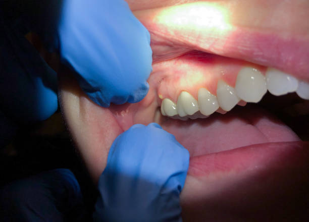 Best Mobile Emergency Dentist in Haubstadt, IN