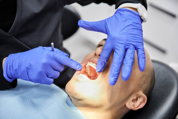 Best Emergency Dentist for Knocked-Out Tooth in Haubstadt, IN