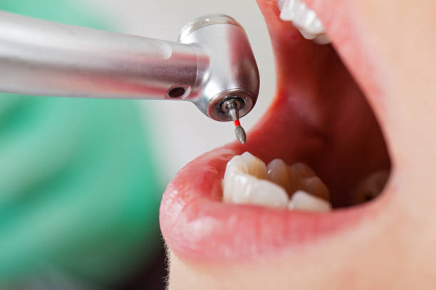 Best Emergency Cosmetic Dentistry in Haubstadt, IN